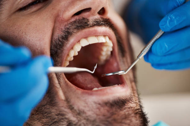 Emergency Dental Services in Middletown, CA